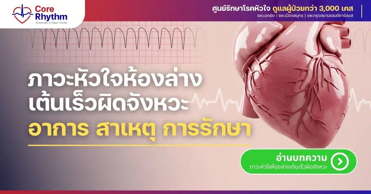 หัวใจห้องล่างเต้นเร็วผิดจังหวะ
